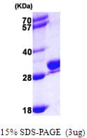 Human RAB27B Protein (Recombinant His)