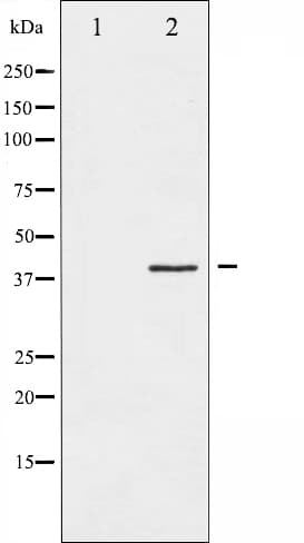 Polyclonal Rabbit anti-Human HDAC8 Antibody (IHC, IF, WB)