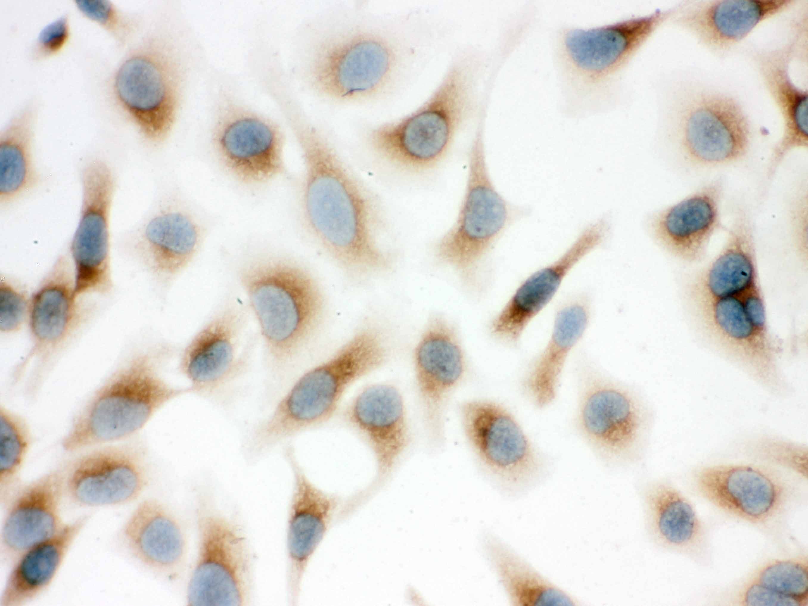 SFTPD / Surfactant Protein D Antibody (aa292-321)