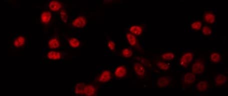 Polyclonal Rabbit anti-Human PRDM12 Antibody (IF, WB)