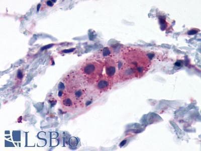 PathPlus™ CASR/Calcium Sensing Receptor Antibody (N-Terminus)