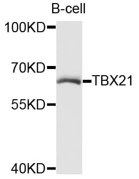 IHC-plus™ Polyclonal Rabbit anti-Human TBX21 / T-bet Antibody (IHC, WB)