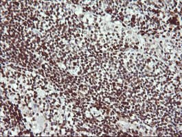 LMO2 Antibody (clone OTI1C8)
