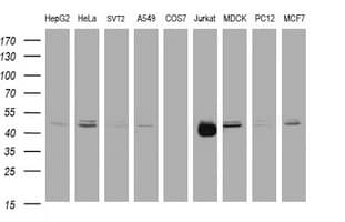 Monoclonal Mouse anti-Human CD2 Antibody (clone OTI1C5, IHC, WB)