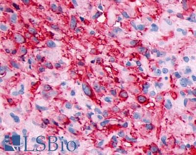 PathPlus™ ADGRD1 / GPR133 Antibody (Cytoplasmic Domain)