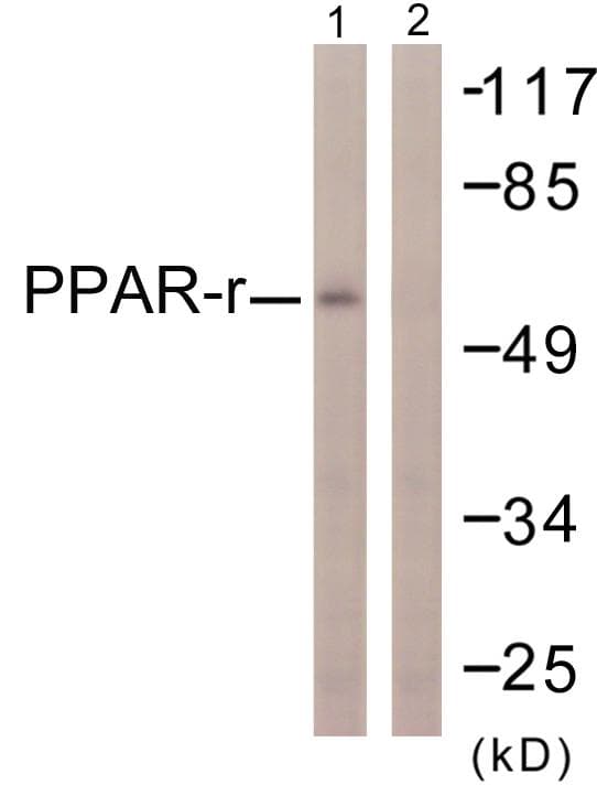PPARG / PPAR Gamma Antibody (p112)