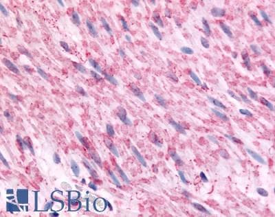 IHC-plus™ Polyclonal Rabbit anti-Human ADRA2C Antibody (Cytoplasmic Domain, IHC)