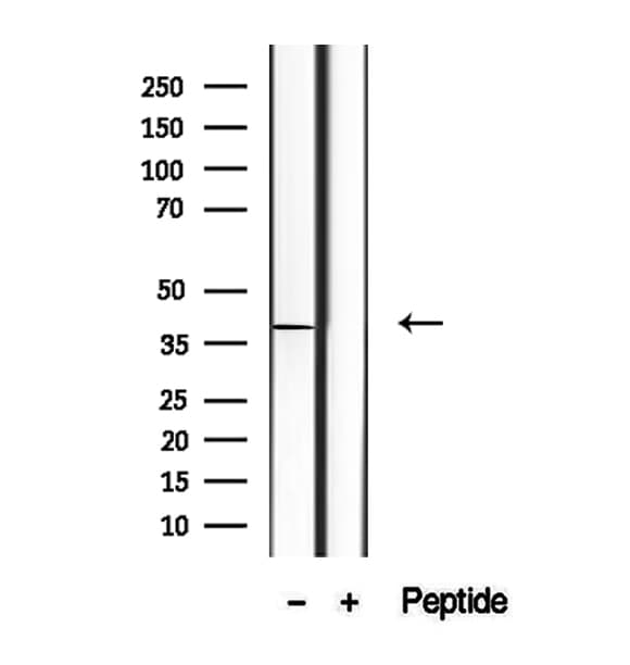 STX16 / Syntaxin 16 Antibody