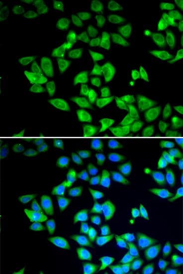 MAP1LC3B / LC3B Antibody