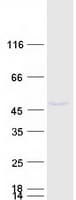 Human PTDSS1 Protein (Recombinant Myc-DDK (Flag))
