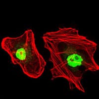 RPA70 / RPA1 Antibody (clone 4C4)