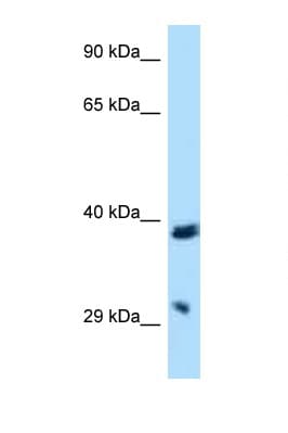 BTLA / CD272 Antibody (aa150-199)