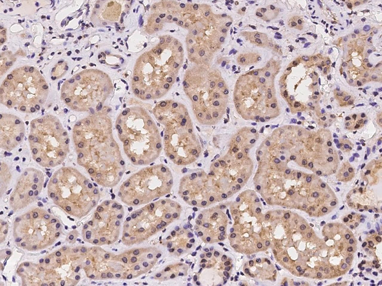 Polyclonal Rabbit anti-Human AKTIP / FTS Antibody (IHC)