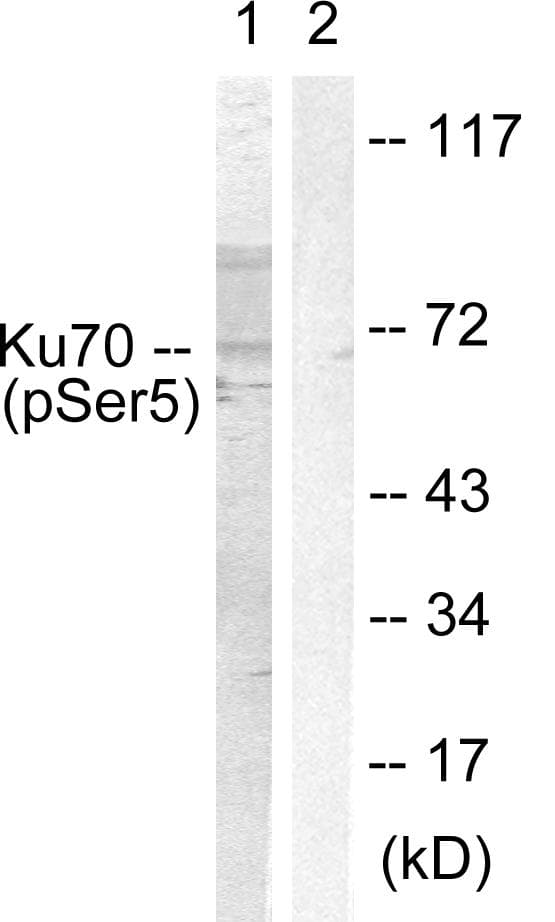 XRCC6 / Ku70 Antibody (phospho-Ser5)