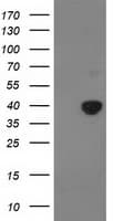 PDHA1 / PDH E1 Alpha Antibody (clone OTI2C10)