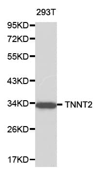 TNNT2 / CTNT Antibody