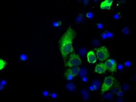 Monoclonal Mouse anti-Human LOX / Lysyl Oxidase Antibody (clone OTI6B11, IHC, IF, WB)