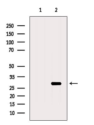 RAB3C Antibody