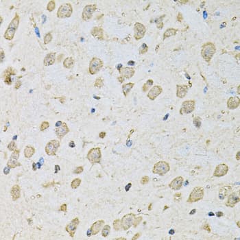 PSMC2 / RPT1 Antibody