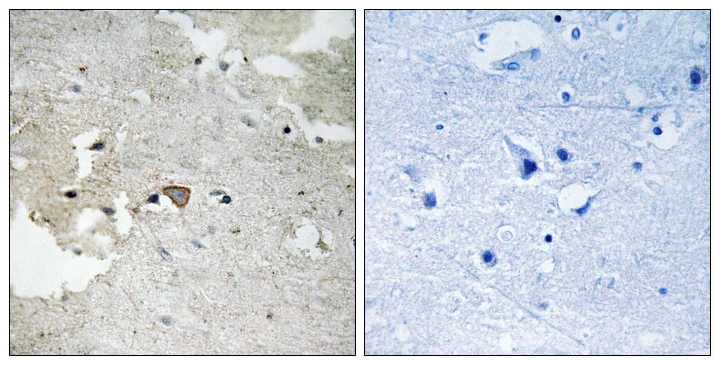 AXL Antibody (phospho-Tyr691)