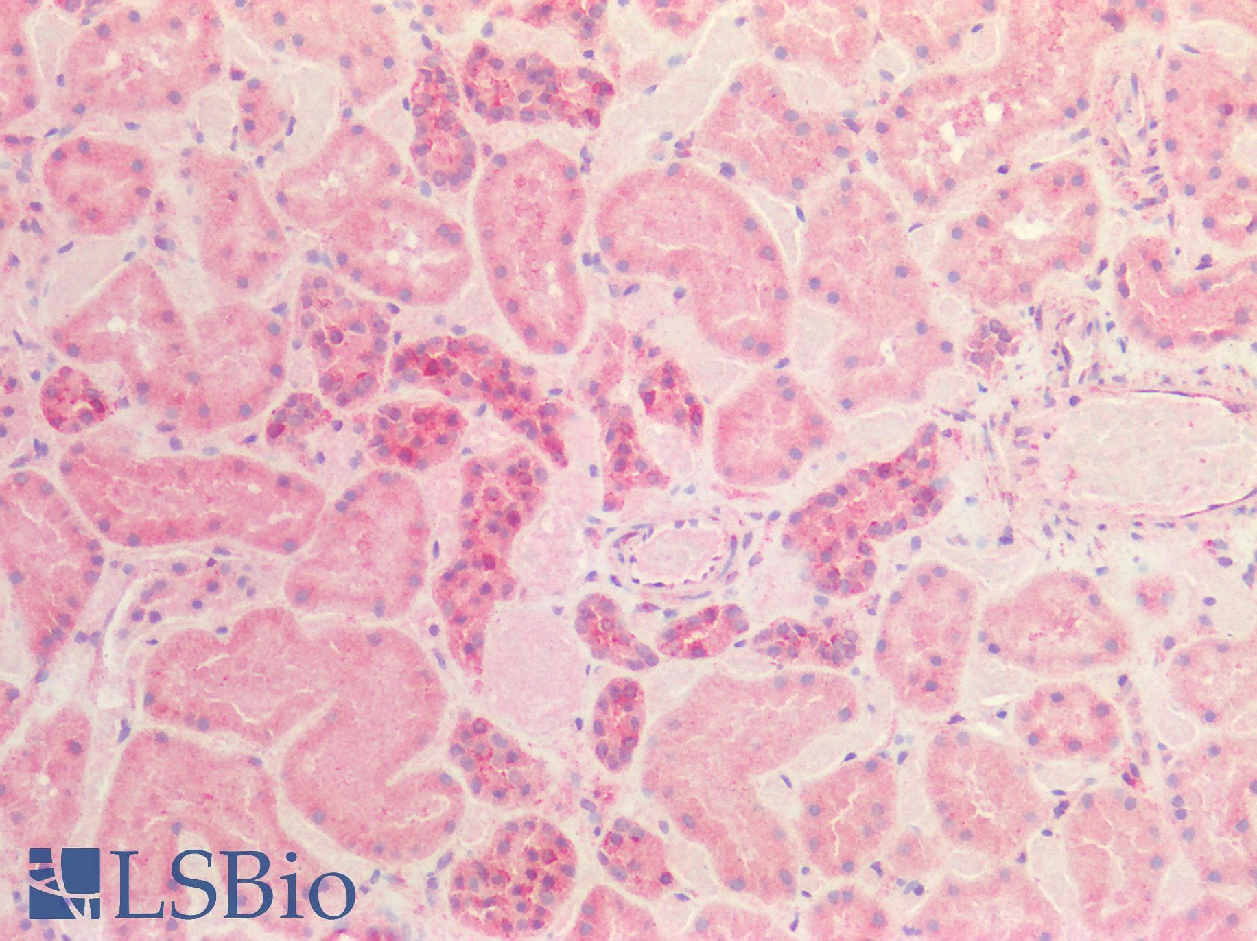 IHC-plus™ ACVR2 / ACVR2A Antibody (aa267-513)