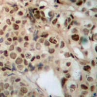 ZFYVE19 Antibody (Internal)