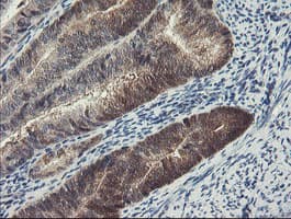 Monoclonal Mouse anti-Human DPH2 Antibody (clone OTI1A12, IHC, WB)