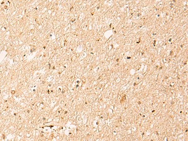 IL1RAPL2 Antibody
