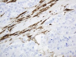 TP / Thymidine Phosphorylase Antibody (aa311-482, clone OTI1E7, Carrier-free)