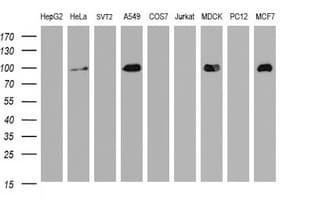 CDH1 / E Cadherin Antibody (clone OTI1F3)