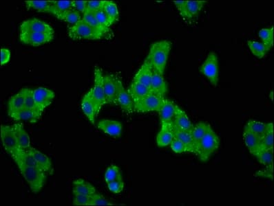 Polyclonal Rabbit anti-Human ACCN1 / ASIC2 Antibody (IHC, IF)