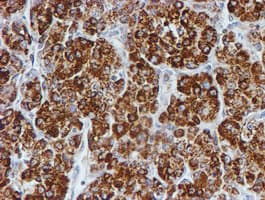 PSMB9 Antibody (clone OTI1G7)