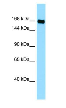 PLXNB3 / Plexin B3 Antibody (aa985-1034)