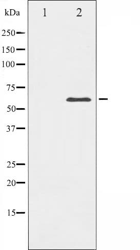 Polyclonal Rabbit anti-Human PAK1 Antibody (IHC, IF, WB)