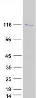 Human BOP1 Protein (Recombinant Myc-DDK (Flag))