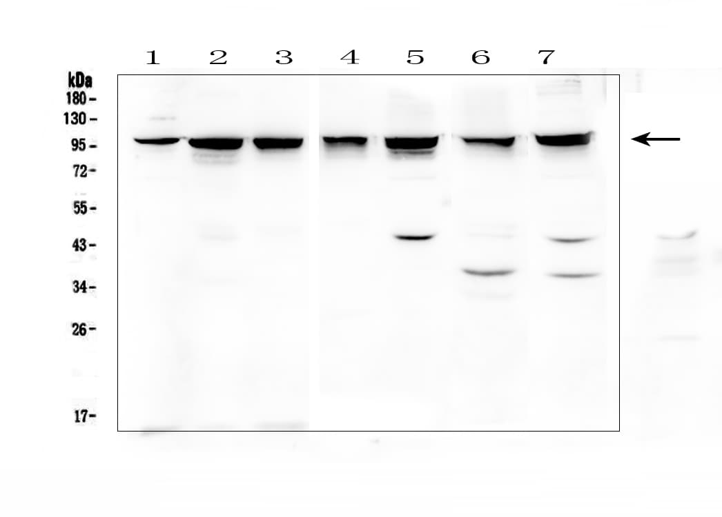 PDCD6IP / ALIX Antibody (aa2-330)