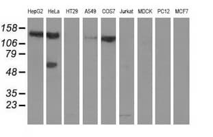 L1CAM Antibody (clone OTI2A5)