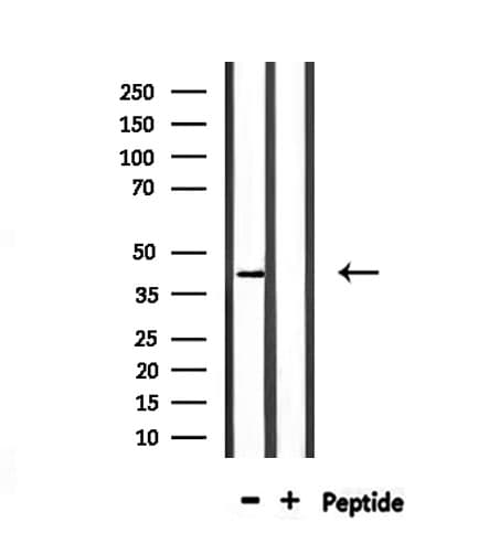 Polyclonal Rabbit anti-Human OPN1SW / Blue Opsin Antibody (IF, WB)