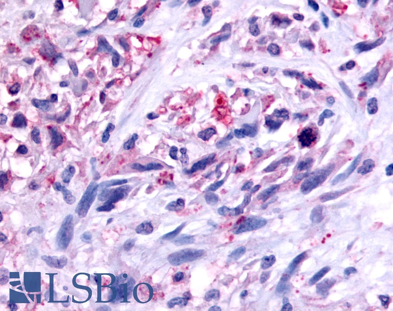 PathPlus™ Polyclonal Rabbit anti-Human GPR45 Antibody (C-Terminus, IHC)