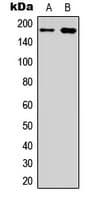 IHC-plus™ Polyclonal Rabbit anti-Human EGFR Antibody (C-Terminus, IHC, IF, WB)