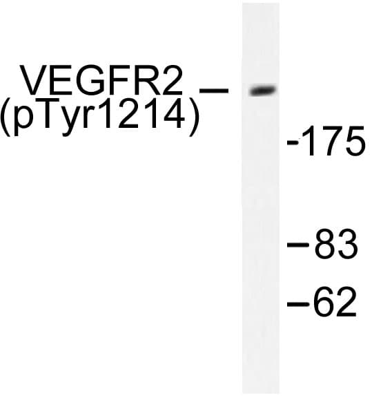 KDR / VEGFR2 / FLK1 Antibody (phospho-Tyr1214)