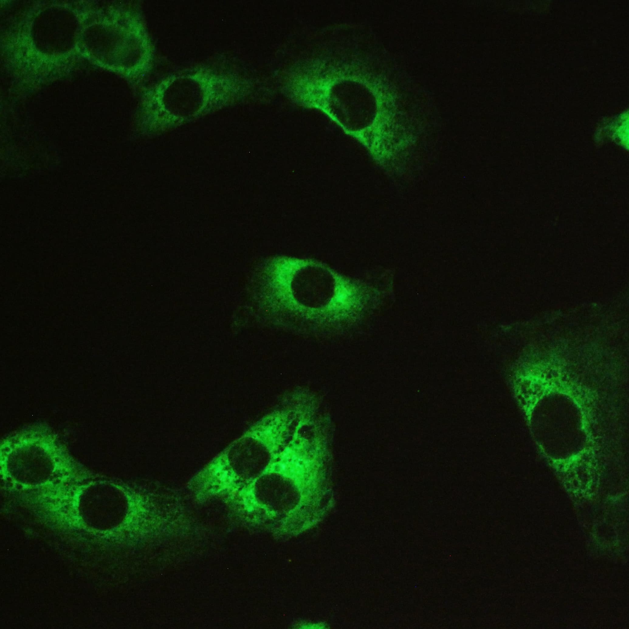 PPP1R12A / MYPT1 Antibody (aa1-40)