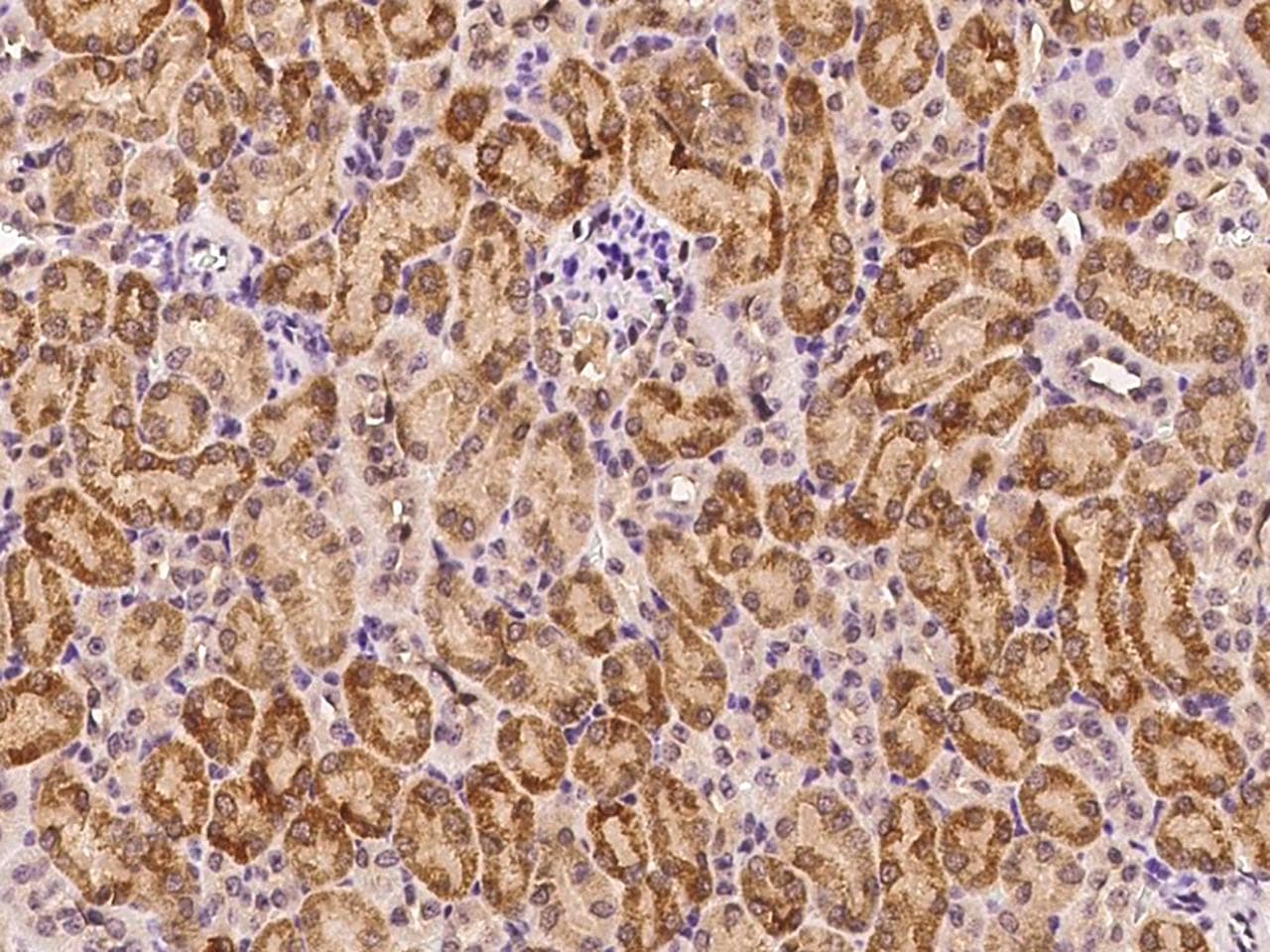 MAP2K3 / MEK3 / MKK3 Antibody (Preservative Free)