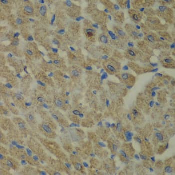 CCBL1 Antibody