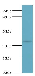 RD / PHYH Antibody (aa1-338)