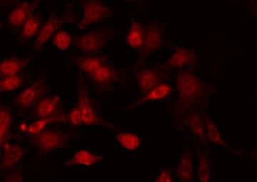 RELA / NFKB p65 Antibody (phospho-Ser281)