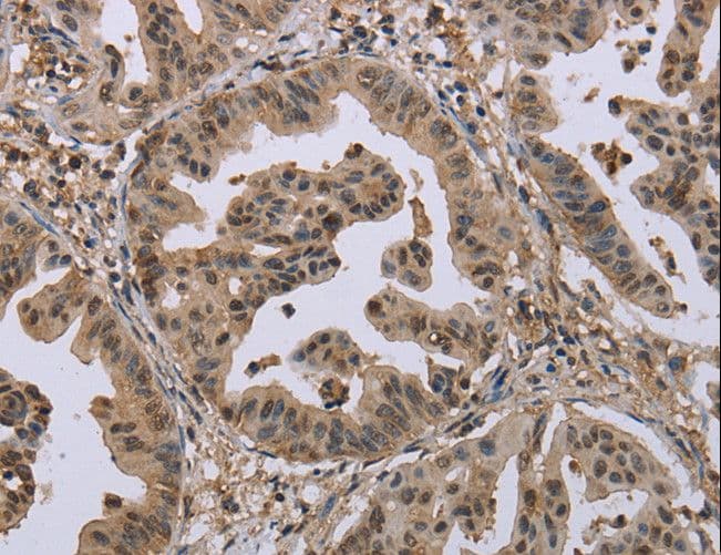 MCC Antibody