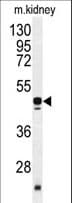 POLDIP2 / PDIP38 Antibody (aa320-349)