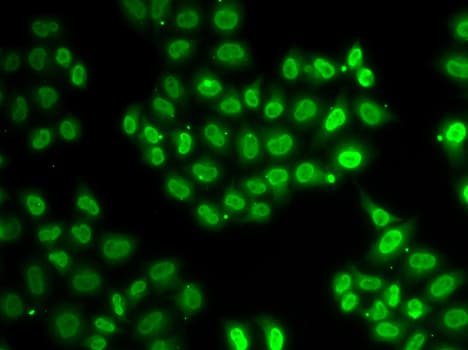 EWSR1 / EWS Antibody