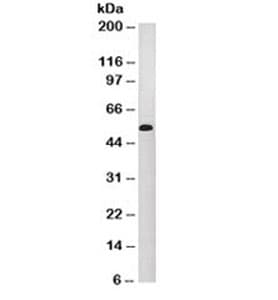 Cytokeratin 10+13 Antibody (clone DE-K13, Azide-free, BSA-free)